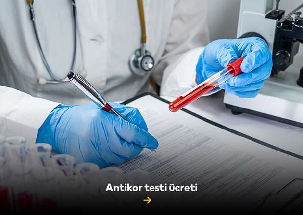 Antikor testi ücreti