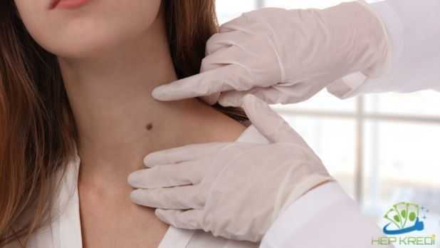 Dermatolog Maaşları Görseli devlette ve özelde dermatolog maaşları